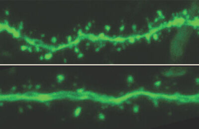 Does Light Level Affect Spatial Learning and Memory?